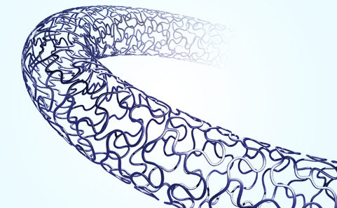 心血管可降解支架-心血管做支架,有什么危害?