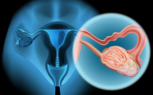 2015美国妇产科协会最新宫颈癌筛查指南发布