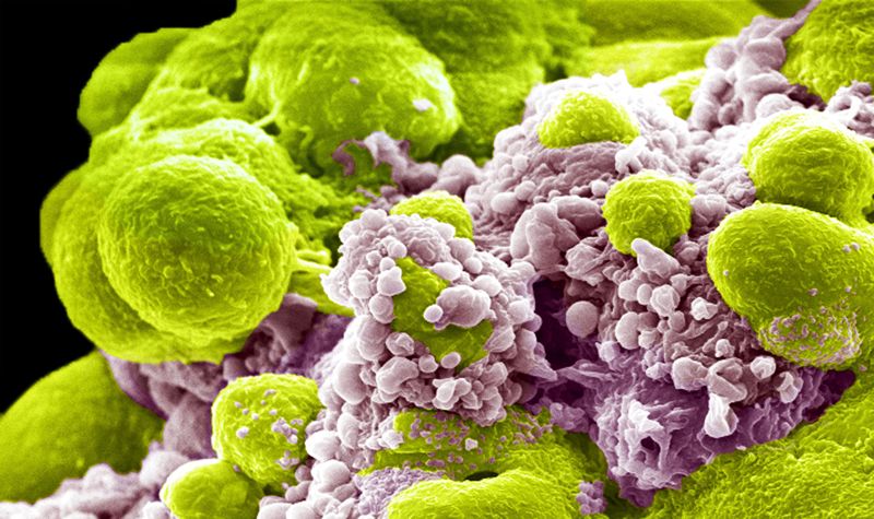 另辟蹊径:研究人员通过靶向休眠细胞对抗癌症