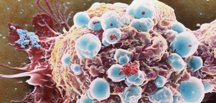 研究人员研究出能够防止癌细胞扩散纳米材料-