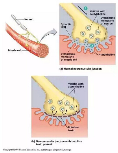 肉毒毒素作用示意图 关于肉毒毒素的来龙去脉和作用原理讲了