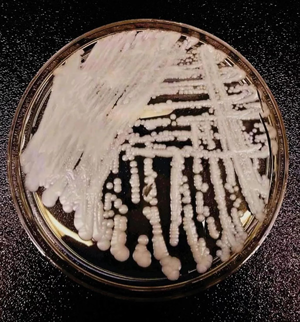 超级真菌并非超级可怕:攻击免疫力低的人,普通