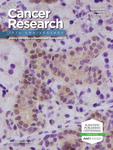 Interactions between Adipocytes and Breast Cancer Cells Stimulate Cytokine Production and Drive Src/Sox2/miR-302b–Mediated Malignant Progression