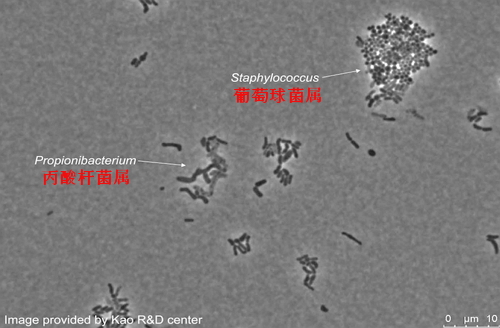 丙酸杆菌属和葡萄球菌属的相互抑制作用