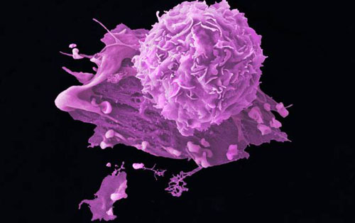 Cell:瑞典科学家发现一种化合物可引发癌细胞“自爆”-观察-生物探索