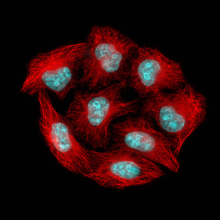 美国研制出能迫使癌细胞自我毁灭的抗癌药物-