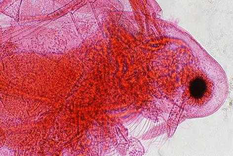 pnas:乳腺癌细胞在低氧状态下转移能力增强