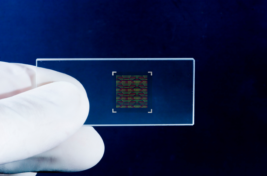 基因芯片快速诊断脊柱结核-观察-生物探索