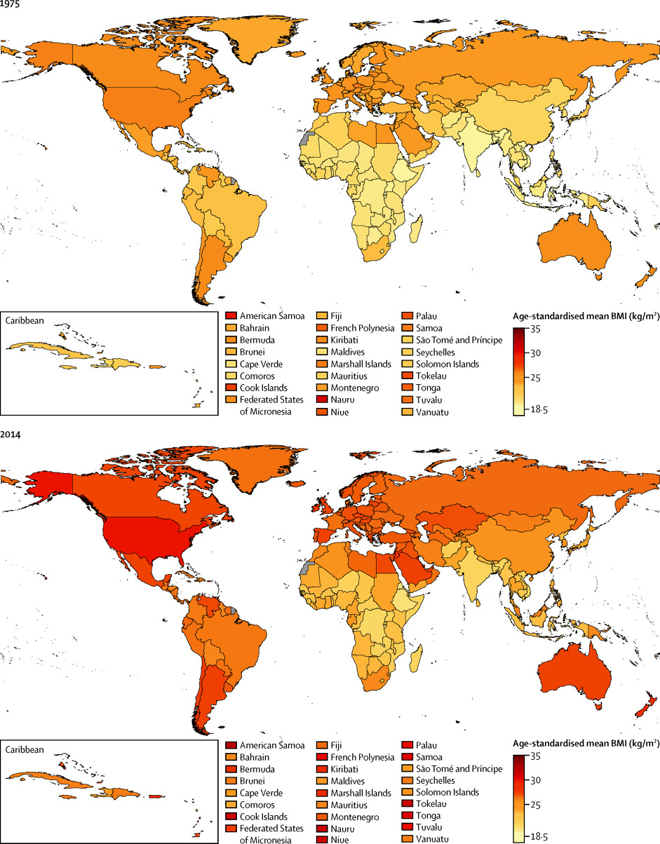 柳叶刀:全球40年大数据分析显示中国肥胖人数居首位