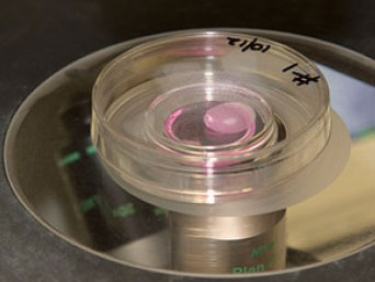 科学家利用人胚胎干细胞培养出肾脏 -我爱干细