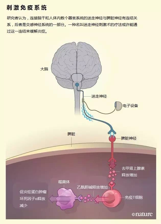 电击迷走神经治疗免疫相关疾病?这并非天方夜谭