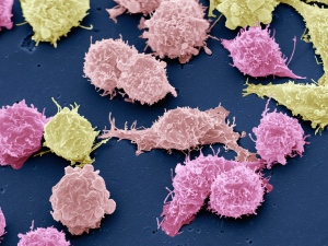 多数抗癌药疗效取决于癌细胞基因组成