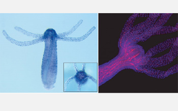 plosone:水螅中发现视觉早期进化线索