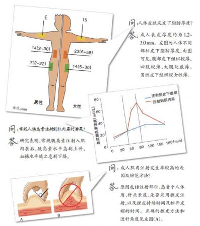 对糖尿病流行病学,循证医学及基础研究的探索