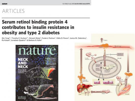2型糖尿病患者视黄醇结合蛋白4与脂代谢的关系