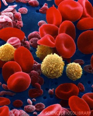 血细胞电镜扫描图(图)