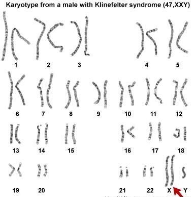 y染色体退化图片