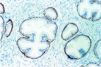 maspin蛋白质能抑制癌细胞扩散
