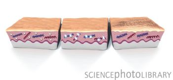 皮肤细胞衰老过程（从左到右是衰老过程）