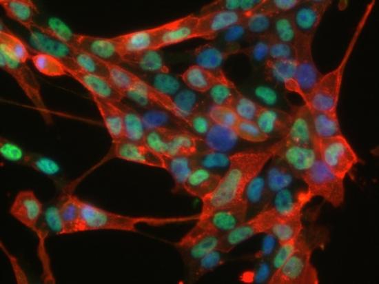德国首次从皮肤细胞中培养出成体干细胞