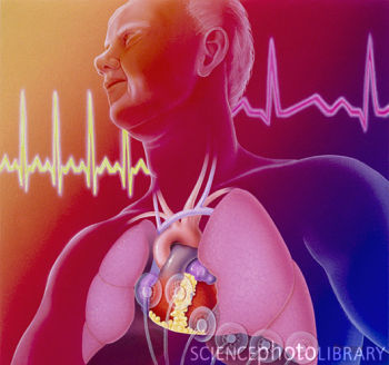 大力水手”蛋白可助心脏缓解压力 