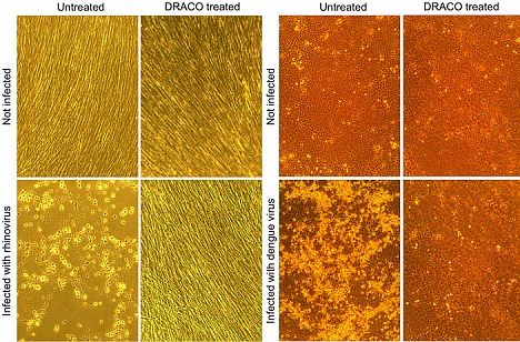 下面一排图片显示的是病毒杀死未经处理的人体细胞，而上排照片显示的是使用DRACO后，细胞没有感染，秩序井然