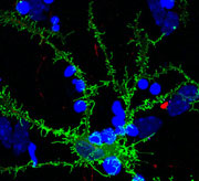 SRGAP2基因复制使人变聪明