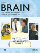 精神分裂症 意图参考文献