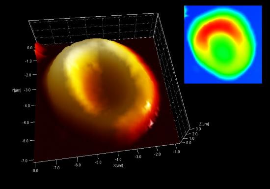 奥茨体内的“5,300岁”的血红细胞