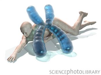 癫痫与15号染色体异常有关