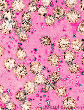 人类卵细胞培养干细胞