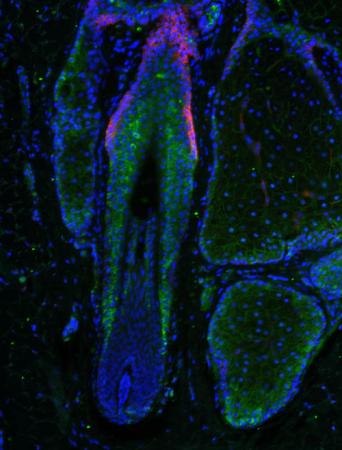人类毛囊微观图：前列腺素D2（绿色）