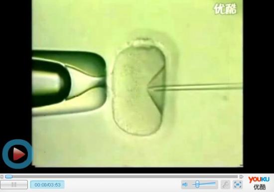 上海出现首例“第三代试管婴儿” PGD可排除遗传病基因