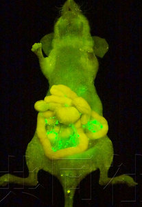 辨别癌细胞的喷雾剂成功研发  有助于发现微小癌肿