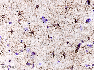 GFAP antibody
