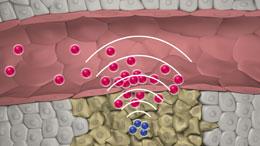 'Signalling' particles enter the tumour and trigger a blood clot that attracts drug-delivering 'receiver' particles.