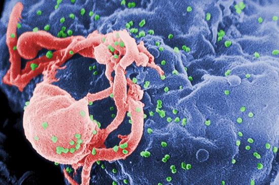 HIV，绿色显示，从淋巴细胞出芽生长