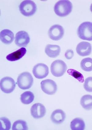 疟疾寄生虫Plasmodium falciparum