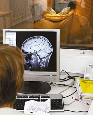 大脑随着人衰老而缩小是一种人类独有的现象