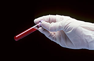 验血可以预测心脏病和癌症风险