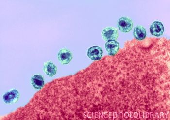 HIV病毒感染的细胞