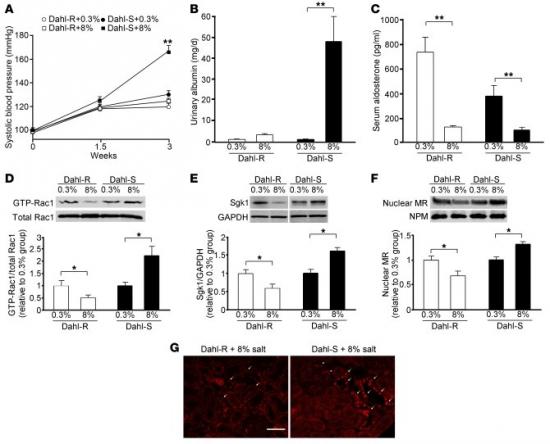 JCI：摄取盐分过多导致高血压有内因
