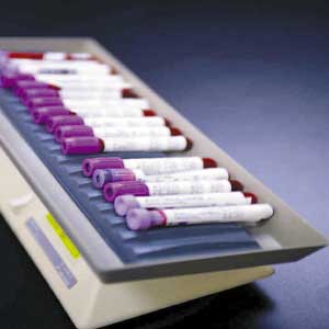 Science:法国开发出能预防丙肝的疫苗