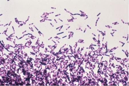人体拥有抵抗艰难梭菌的天然机制