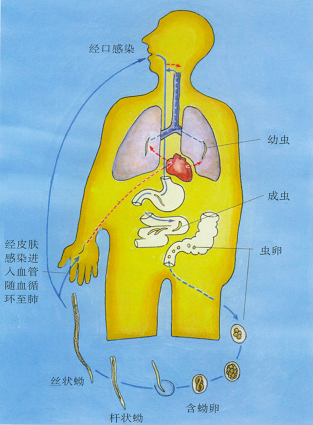 人体内的8种寄生虫图赏