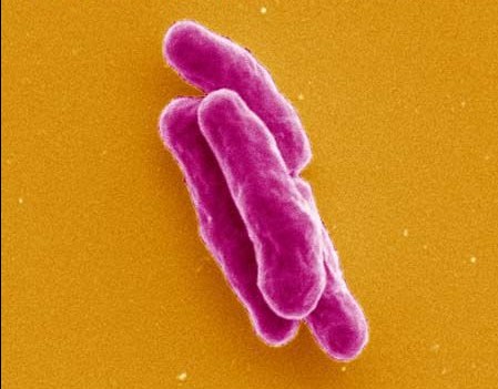 Science:如何消灭结核菌