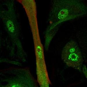 重编码的心肌细胞 （绿色和红色表示心肌蛋白分布）