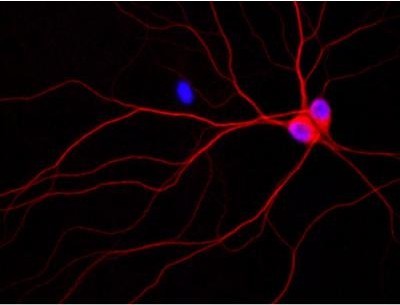 Image of rat neurons growing in a culture dish. 
