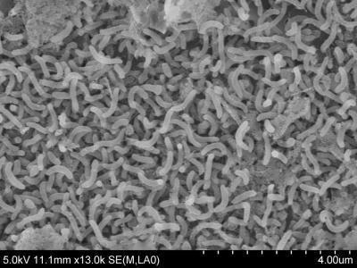 This is an electron micrograph of SAR11 strain HIMB4 cultured from Kaneohe Bay, Oahu, Hawaii