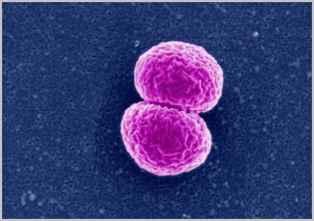 引起脑膜炎的球菌图片